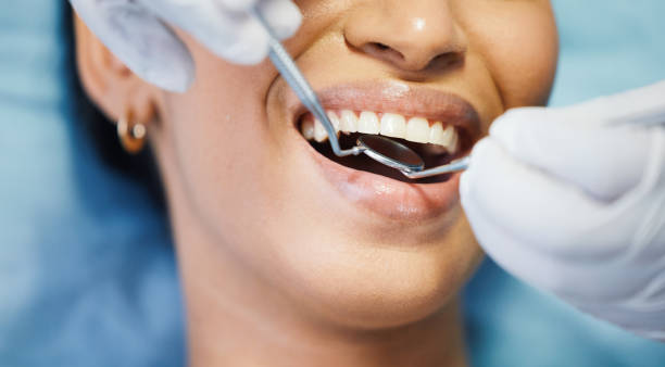 Best Emergency Dental Care for Broken or Chipped Teeth in Corbin, KY